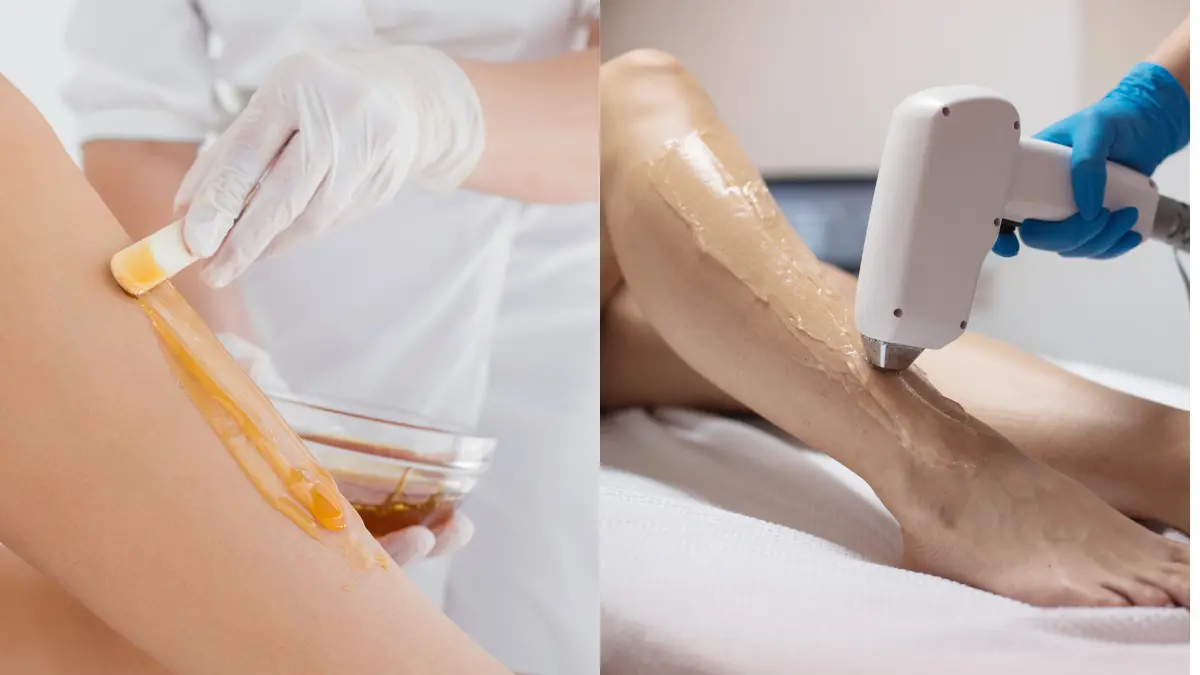 Depilação a cera versus Depilação a laser para mulheres