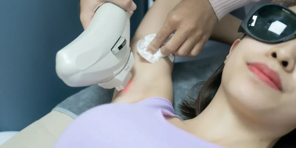 Depilação a Laser nas Axilas